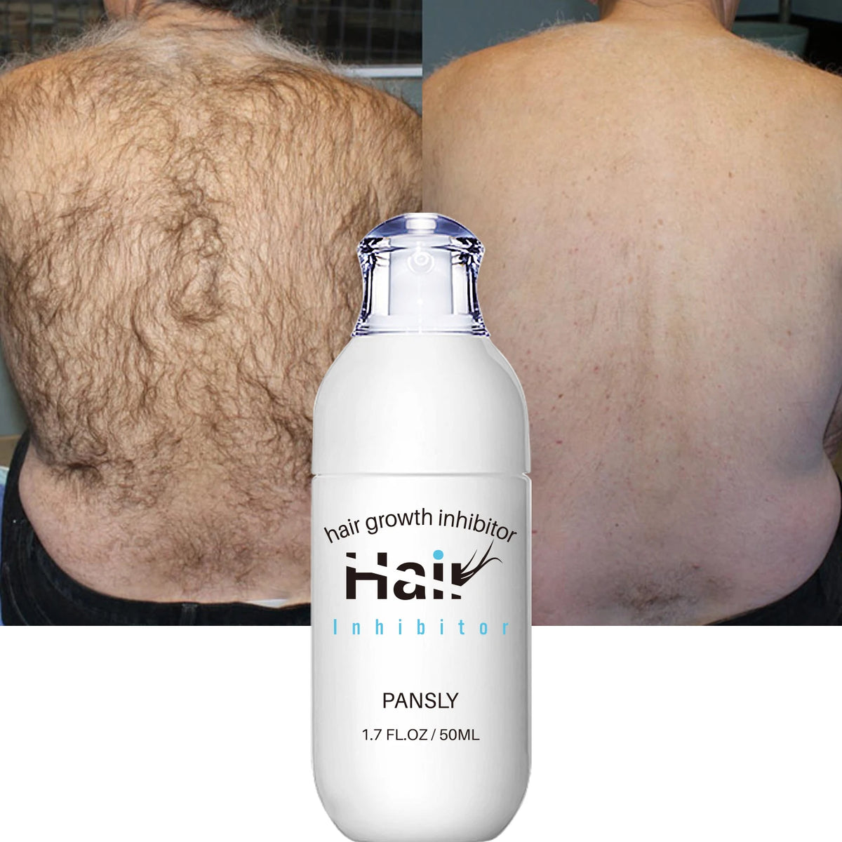 Spray Depilator Revitalique – Epilare Fără Durere & Piele Fină